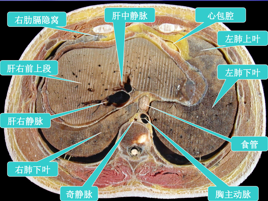 腹部的横断层解剖_第3页