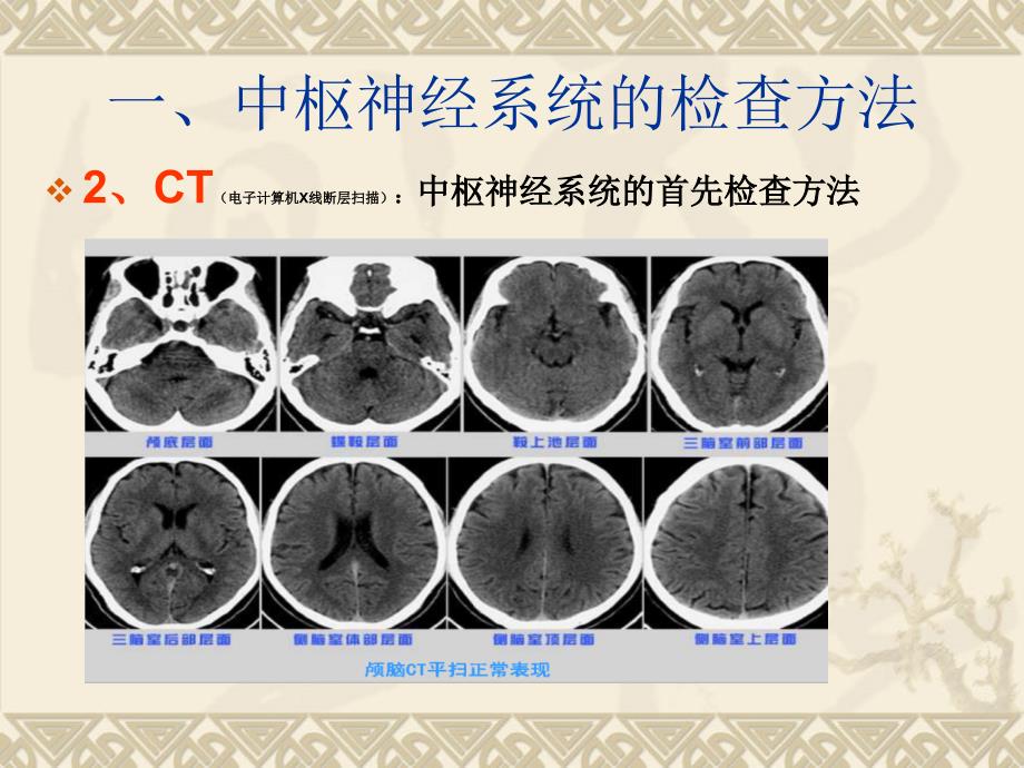 中枢神经系统影像学检查2_第4页