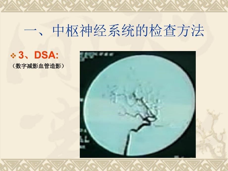 中枢神经系统影像学检查2_第5页