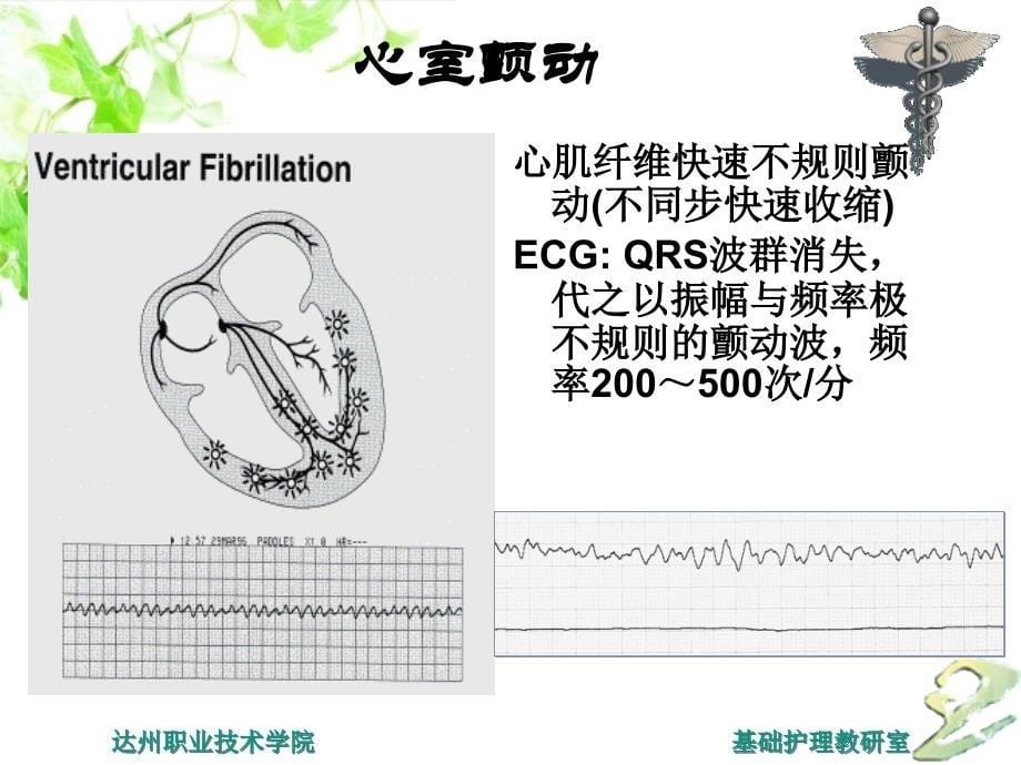 心肺脑复苏技术与护理课件_第5页