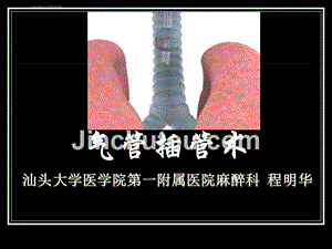 气管插管(大学生临床技能大赛培训)课件