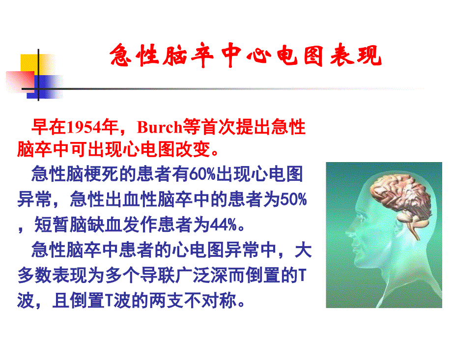 急性脑卒中心电图表现课件_第3页