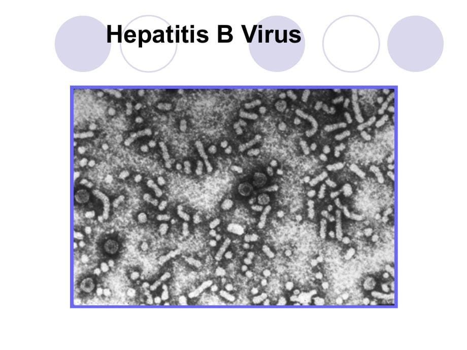 病毒性肝炎标志物检测课件_第5页