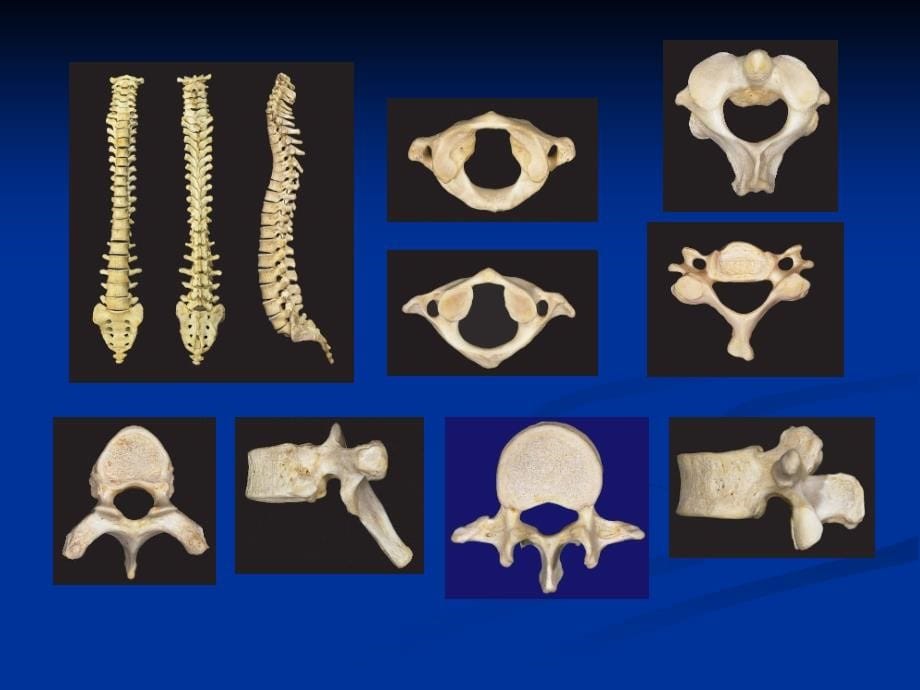 脊柱和骨盆骨折-外科学_第5页