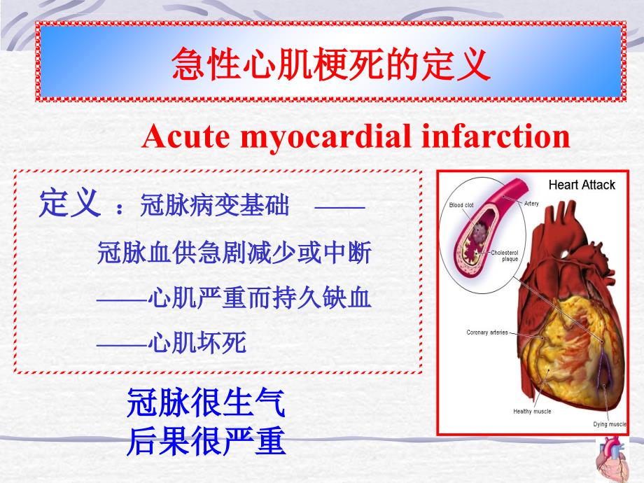 急性心肌梗死的护理1课件_第4页