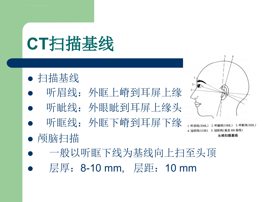 头颅ct及mri的临床课件_第3页