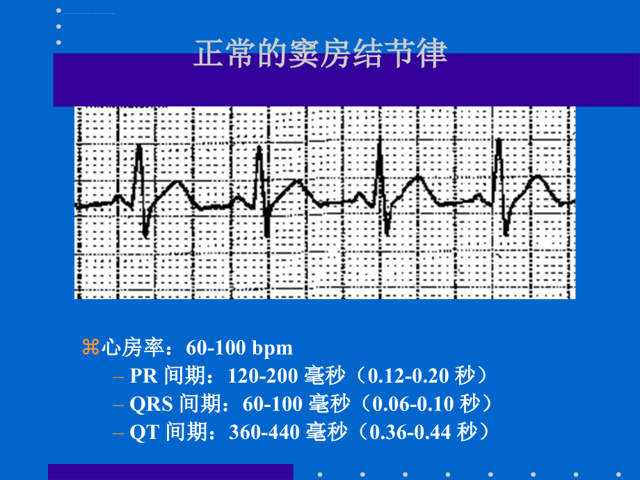 心律失常各论_第2页