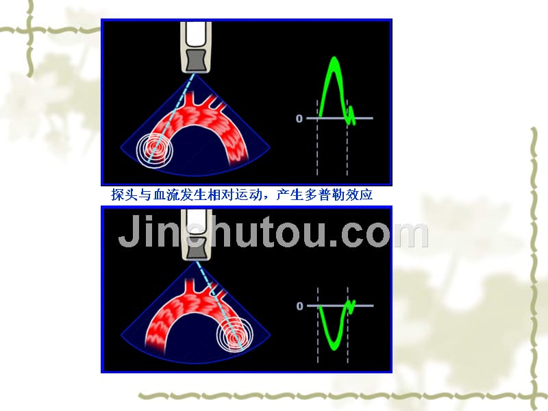 彩色多普勒血流成像原理_第4页