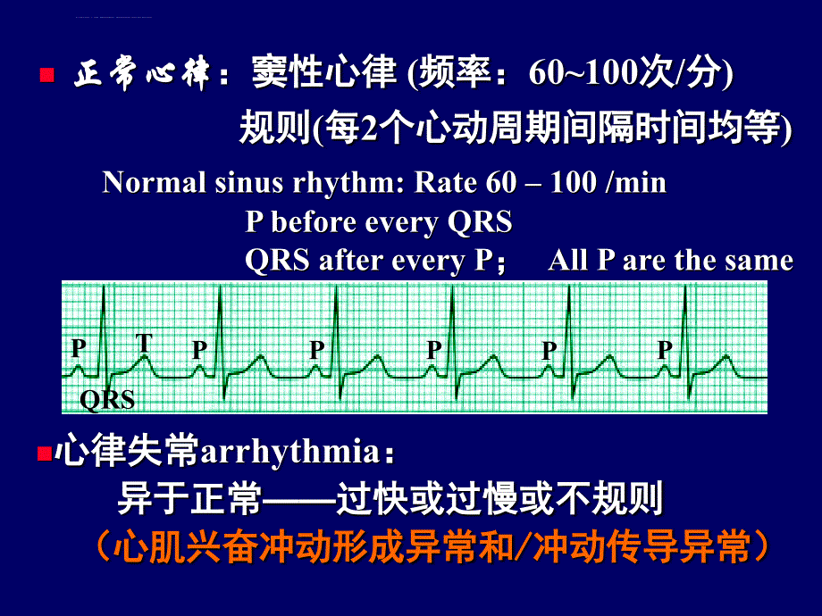 心率失常幻灯片_第2页