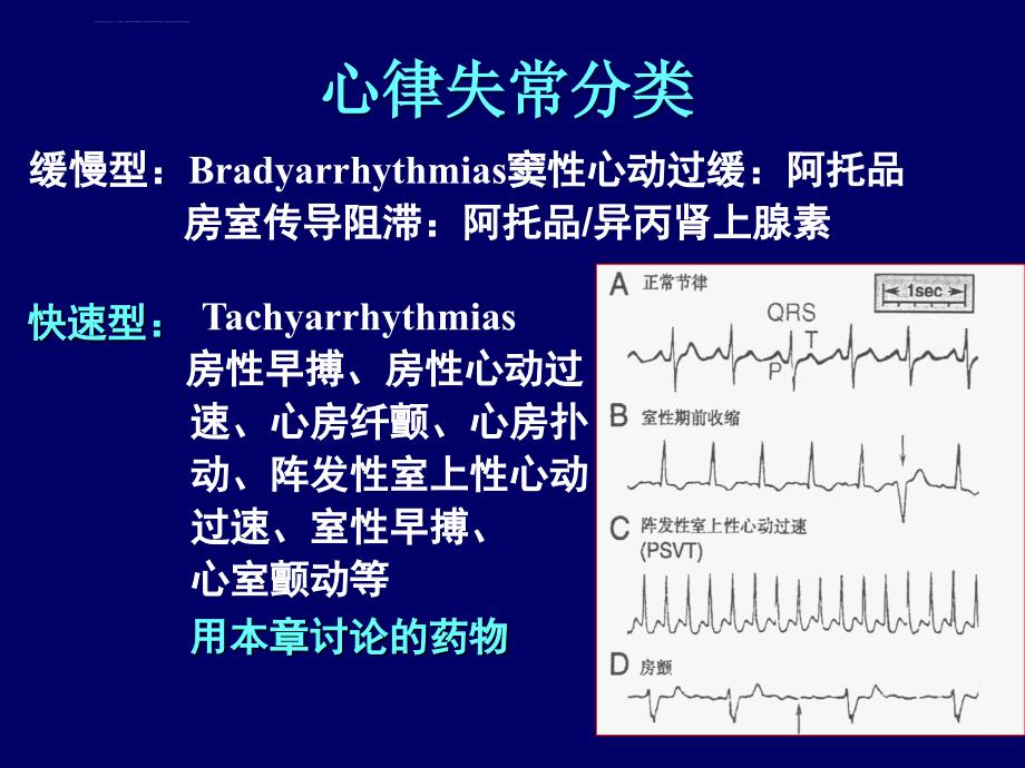 心率失常幻灯片_第3页