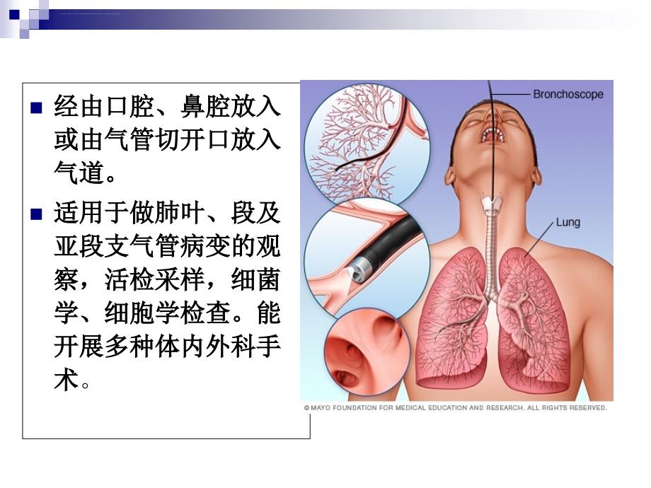 支气管镜检及治疗的麻醉课件_第4页