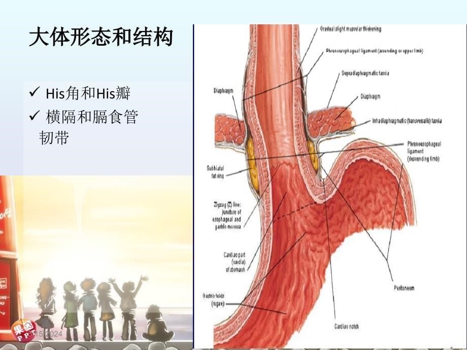 胃食管结合部腺癌及相关解剖1课件_第5页