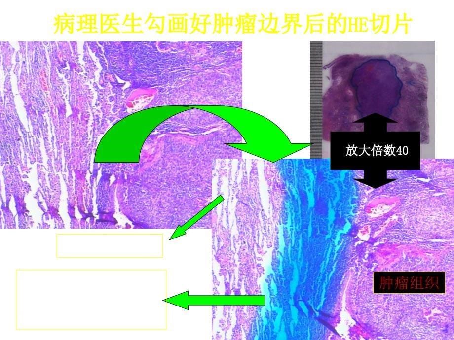 肿瘤综合治疗进展2课件_第5页