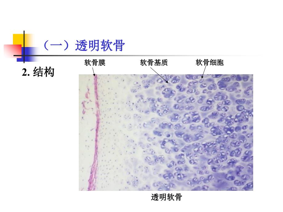 软骨和骨（nxpowerlite）课件_第4页