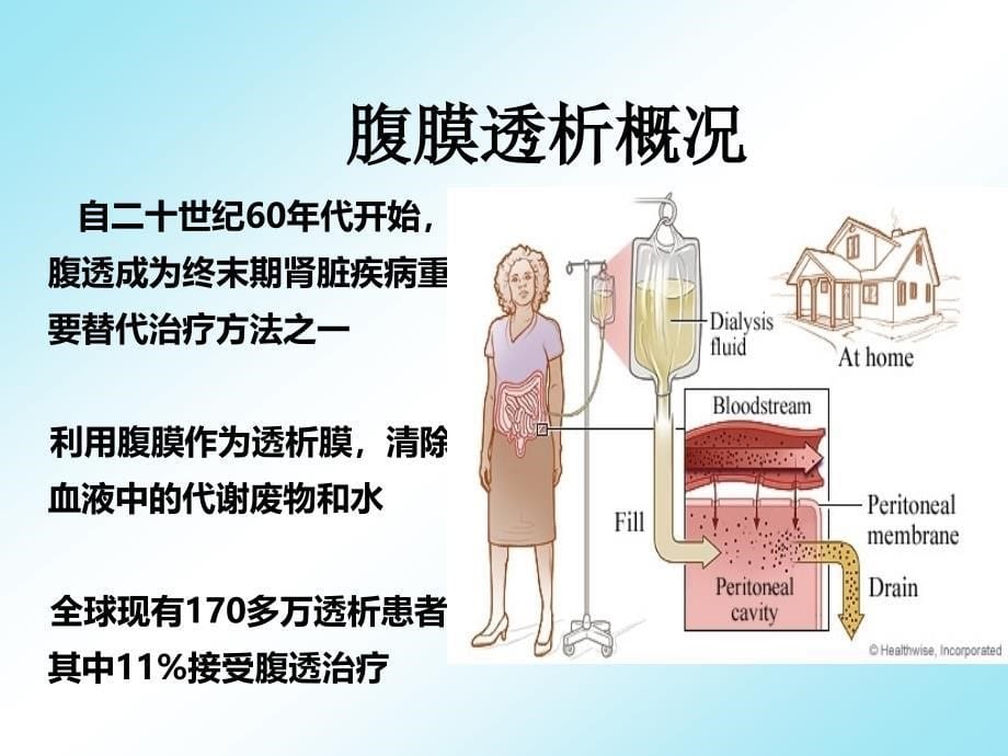 腹膜透析基础2012-11-29_第5页