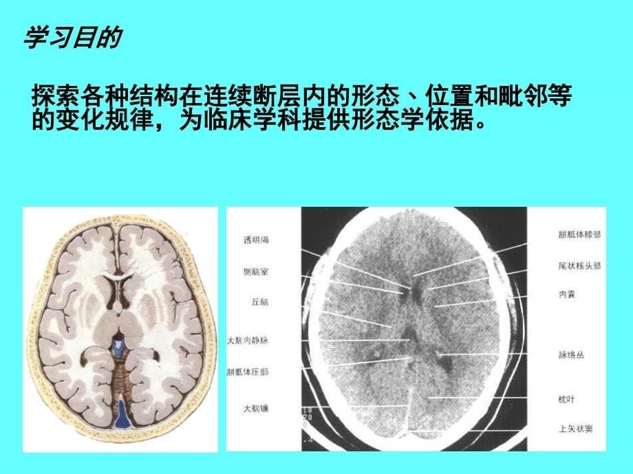 绪论脑脑膜脑池_第5页