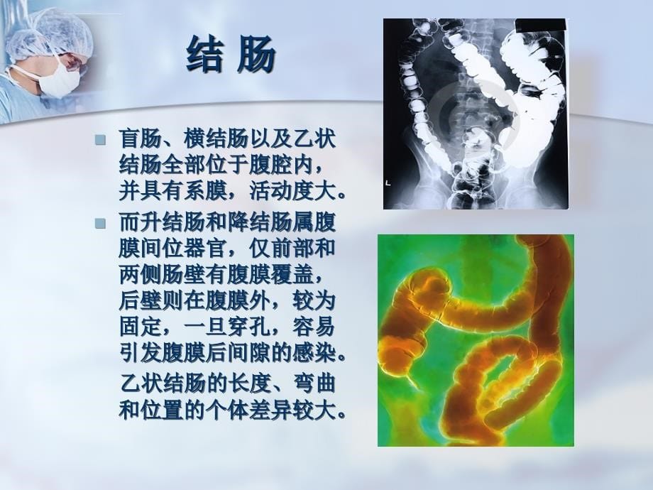 结肠癌患者的围手术期护理课件_第5页