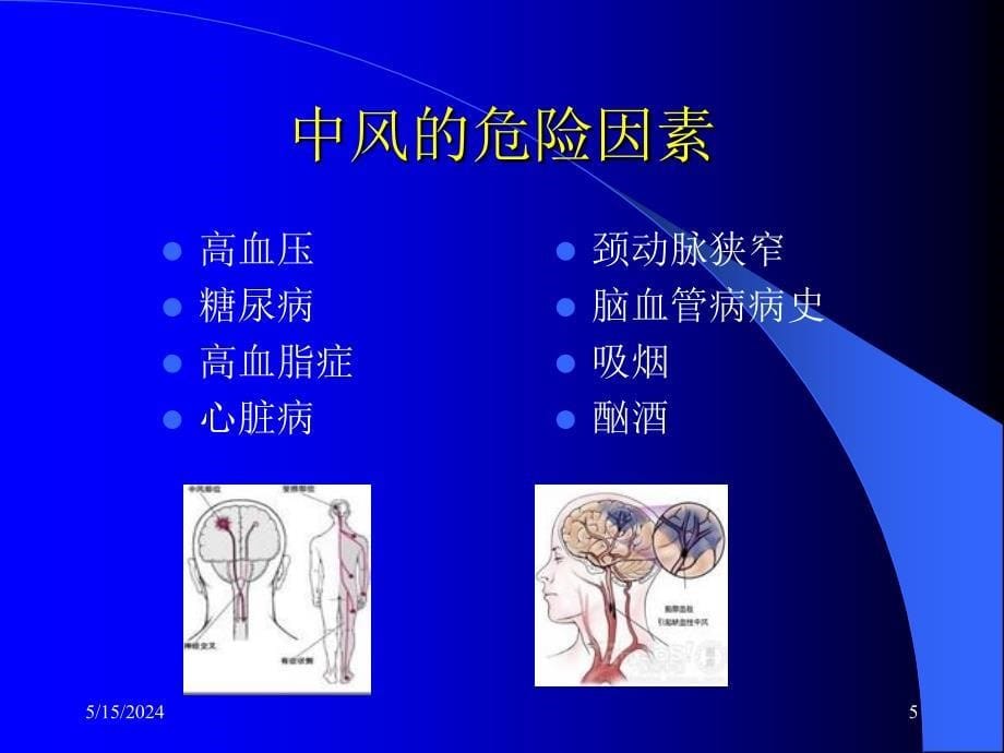 中风患者的康复治疗;ppt分析_第5页