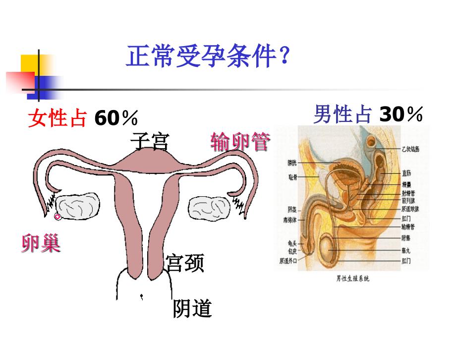 不孕症科普--钱素敏课件_第4页