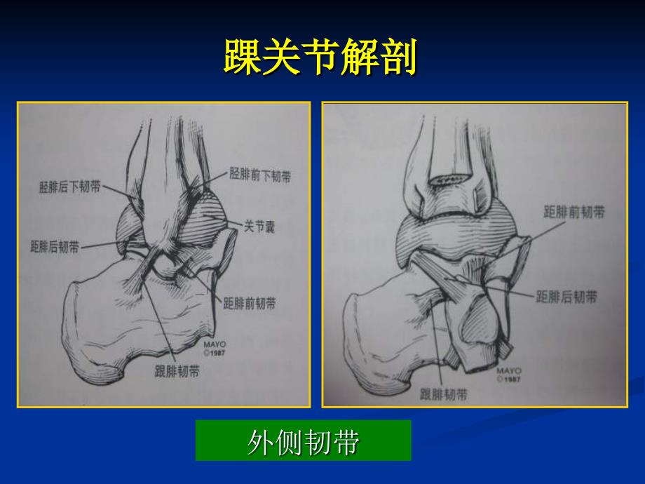 踝关节影像诊断-ppt课件_第3页