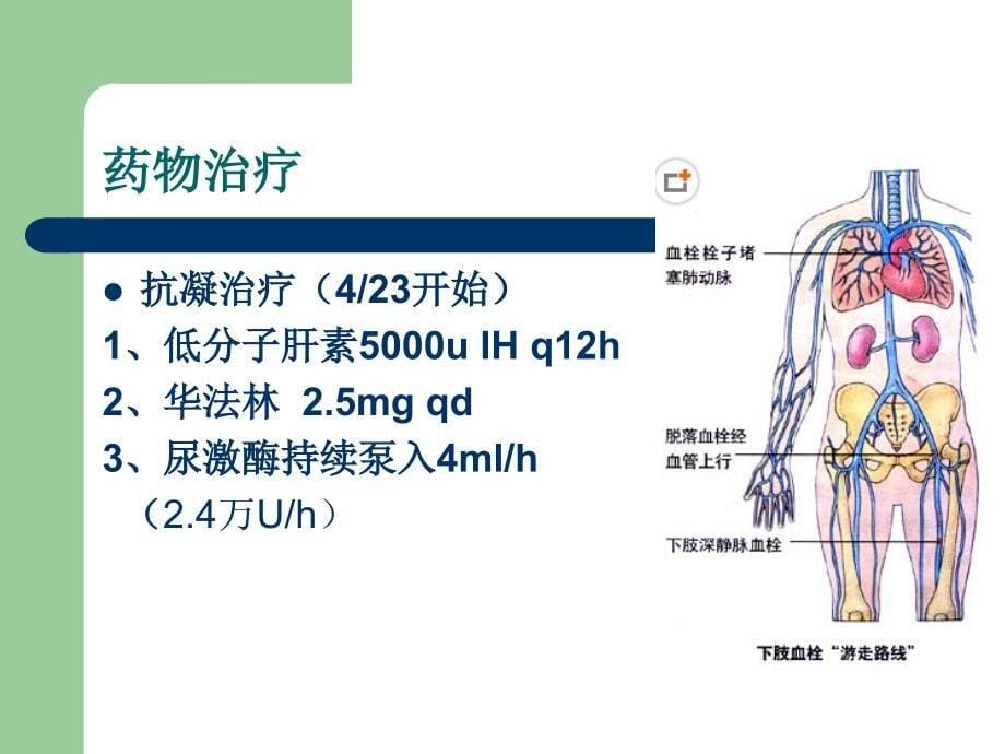 新心血管内科下肢深静脉血栓护理20140429_第5页