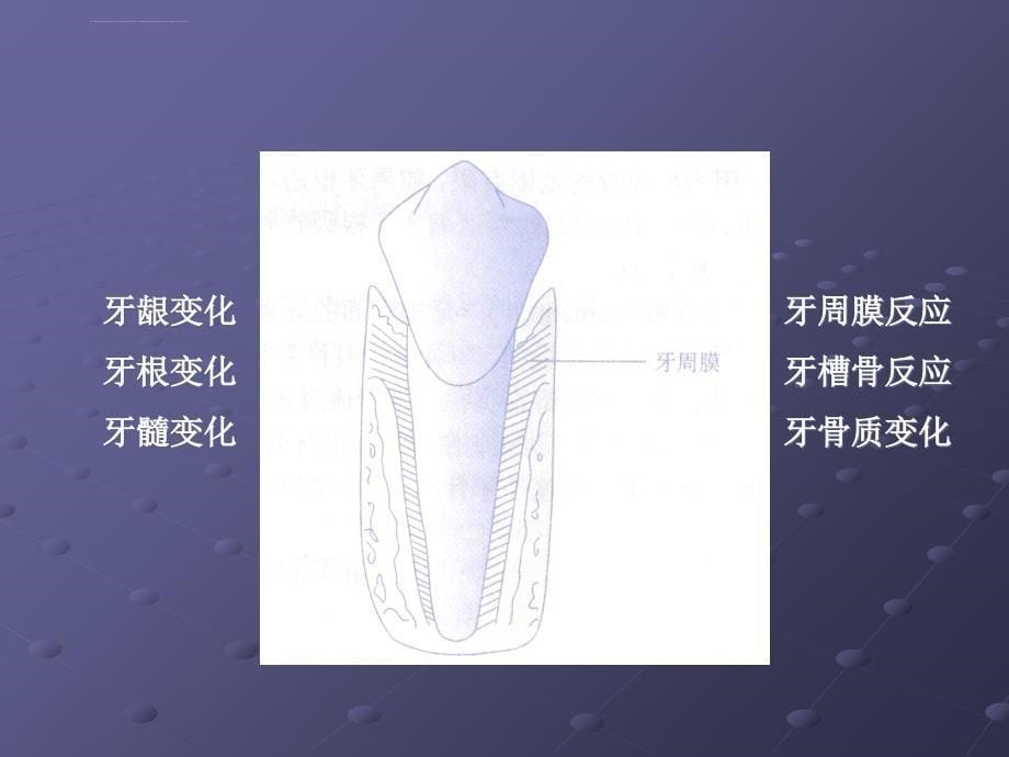 北医正畸-第6章-正畸治疗的生物机械原理_第5页