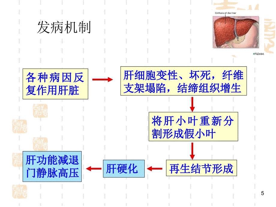 肝硬化病人的护理查房-课件_第5页