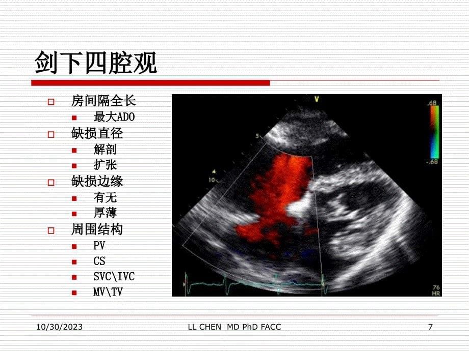 先天性心脏病封堵治疗基础超声影像_第5页