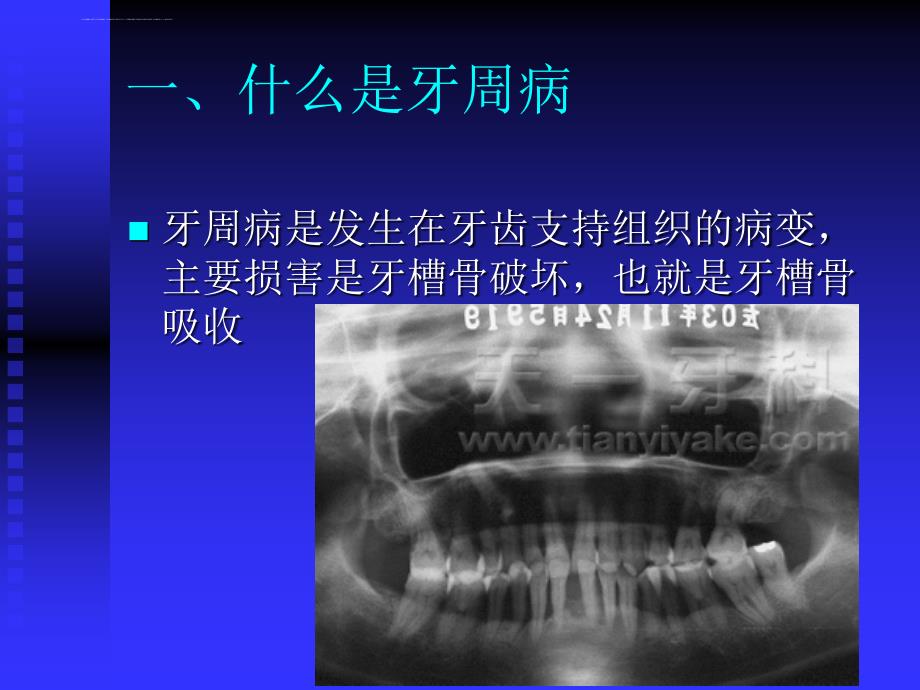 牙周健康讲座广州天一牙科诊所--刘剑_第1页