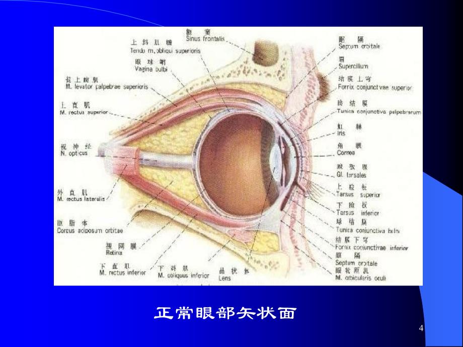 视网膜动脉阻塞-高压氧_第4页