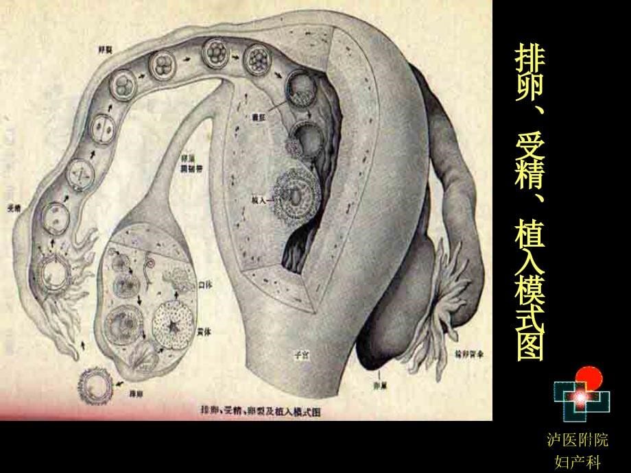 不孕症妇女的护理-ppt文档_第5页