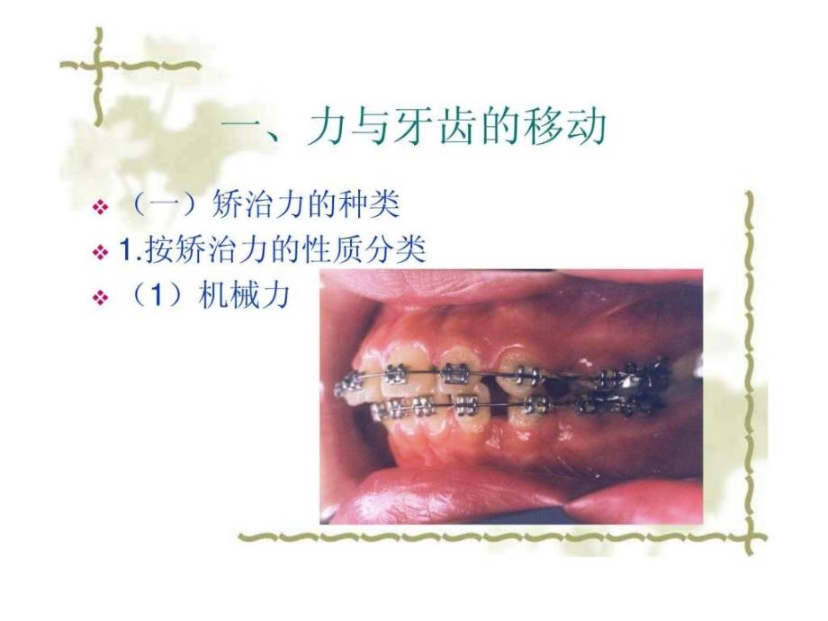 口腔正畸学-第五章-正畸治疗的生物机械原理_第2页