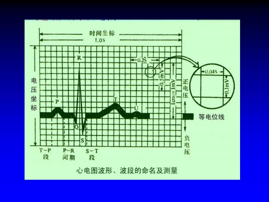 c正常心电图精讲_第1页