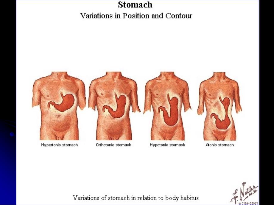 医学课件-胃-stomach局部解剖(精)_第4页