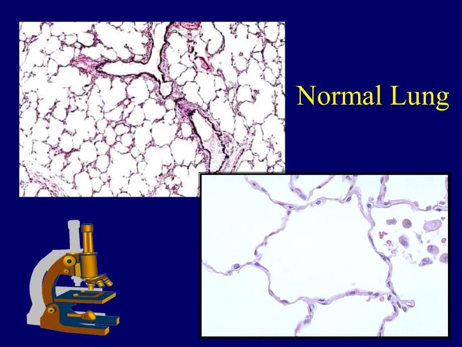 病理学呼吸系统精美课件(附大量图片)_第5页