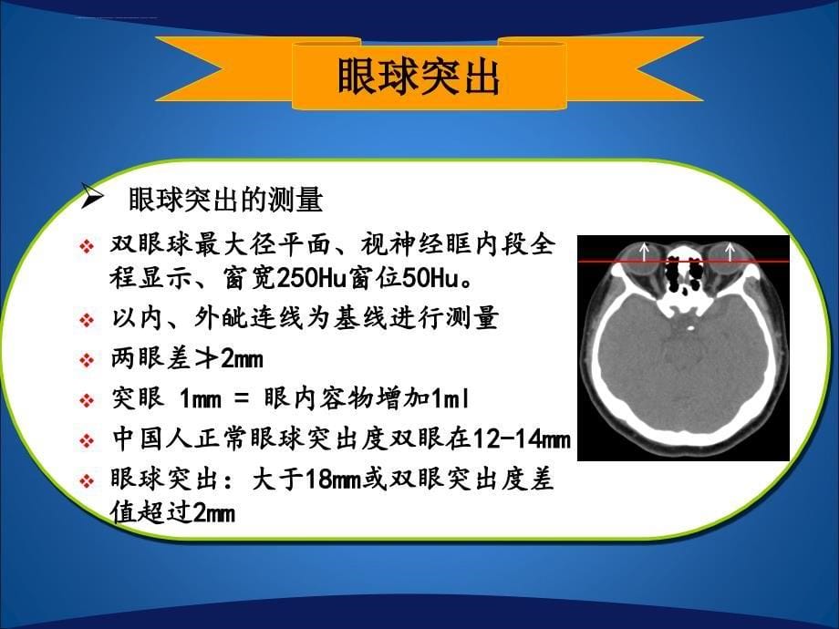 眼外肌增粗课件_第5页