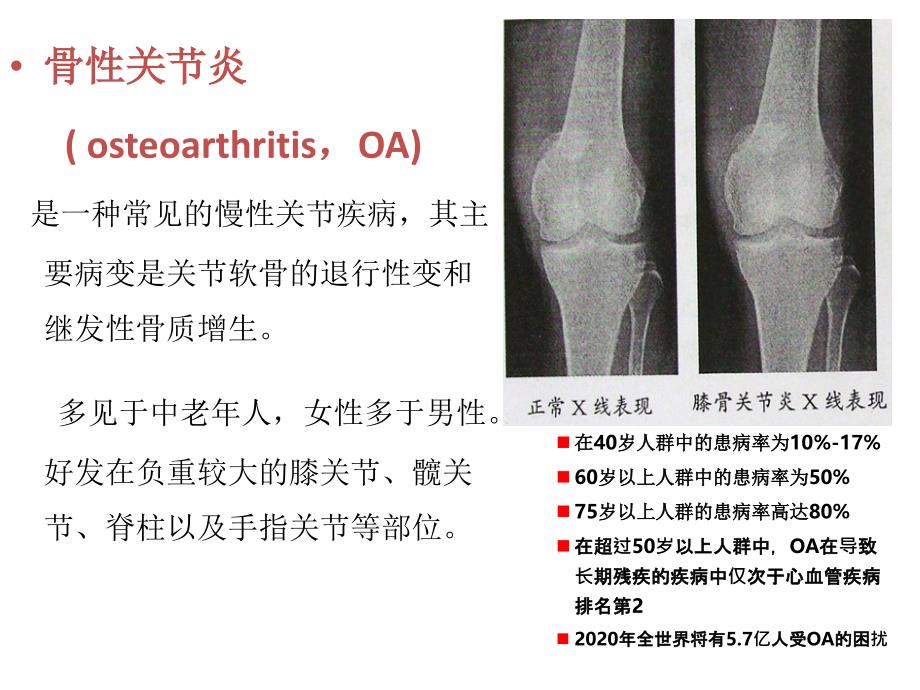 从骨关节炎指南演变看nsaids在骨关节中的意义讲义课件_第2页