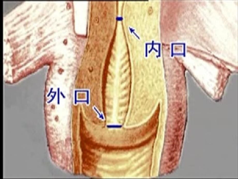 宫颈癌讲义课件_第5页