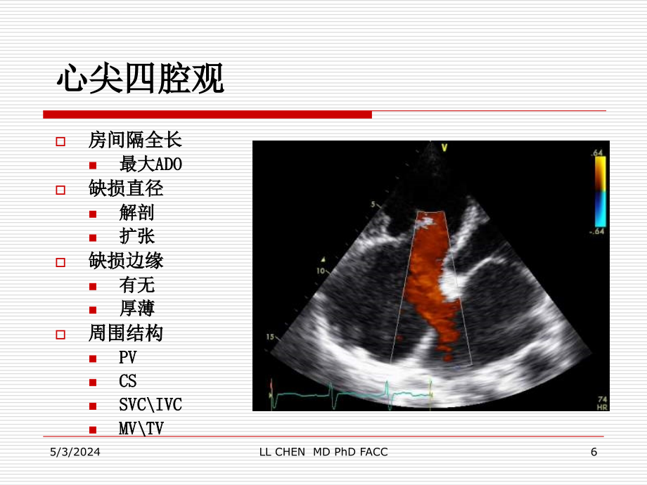 先天性心脏病封堵治疗基础超声影像课件_第4页