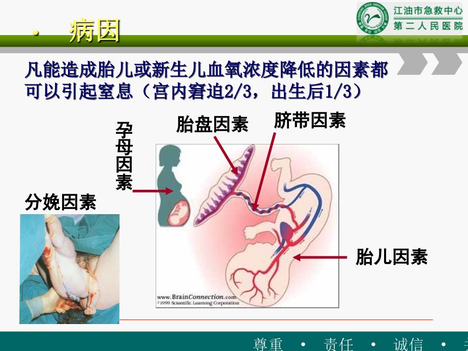 新生儿窒息第七版教材课件_第2页