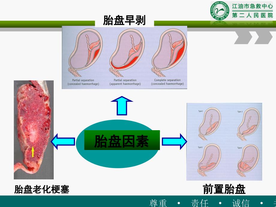 新生儿窒息第七版教材课件_第4页