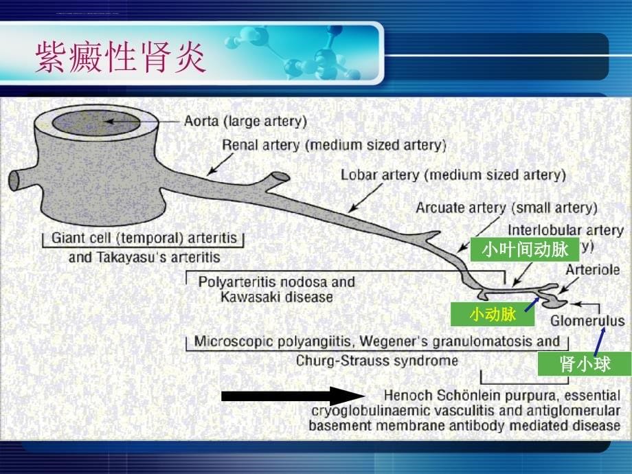 过敏性紫癜肾炎诊诒进展ppt幻灯片_第5页