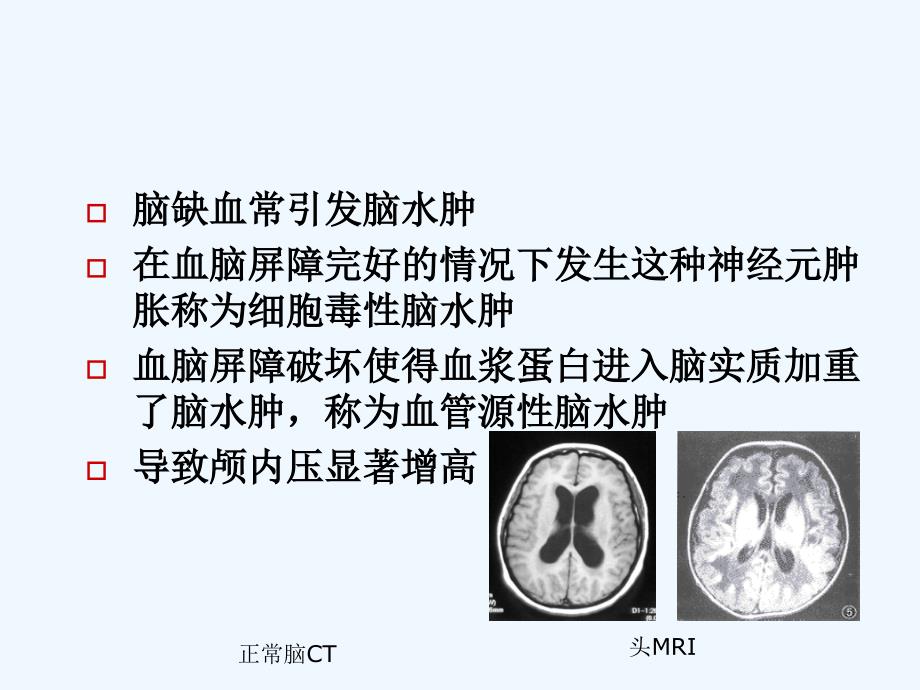 围术期脑保护进展-..课件_第4页