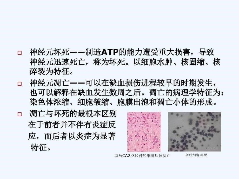 围术期脑保护进展-..课件_第5页