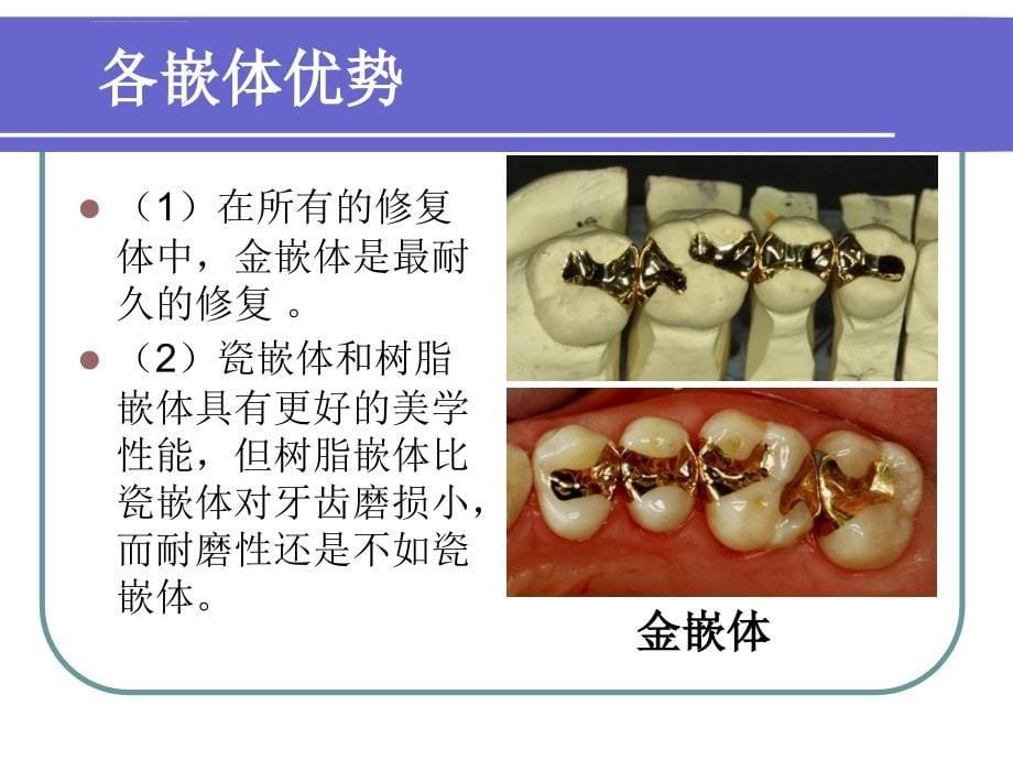 铸造金属全冠的制作分解课件_第5页