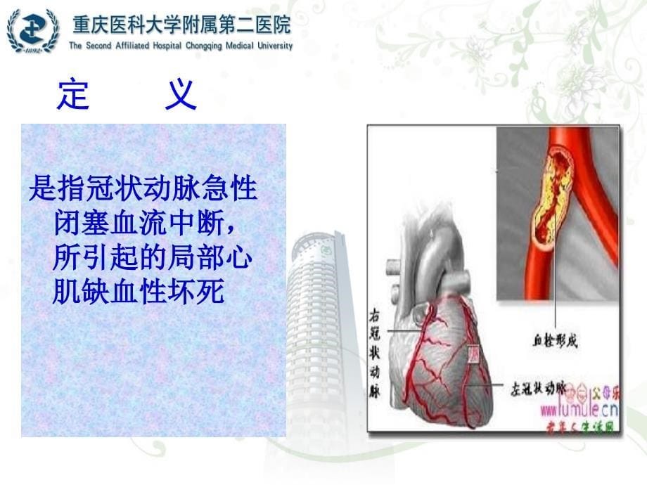 心肌梗死教学查房幻灯片_第5页