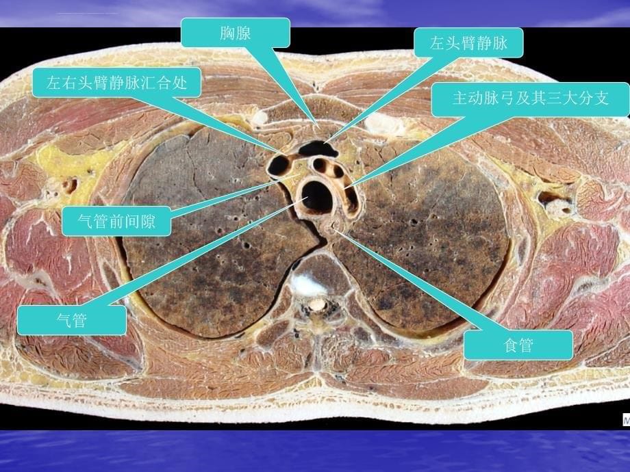 胸部的横断层解剖ppt幻灯片_第5页