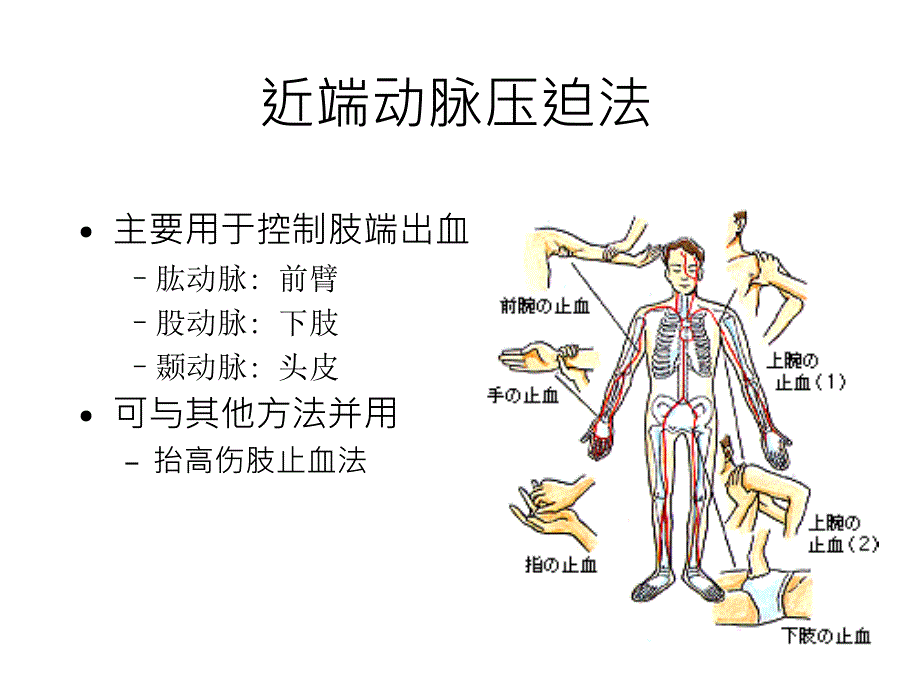 骨折病人的止血搬运-课件_第4页