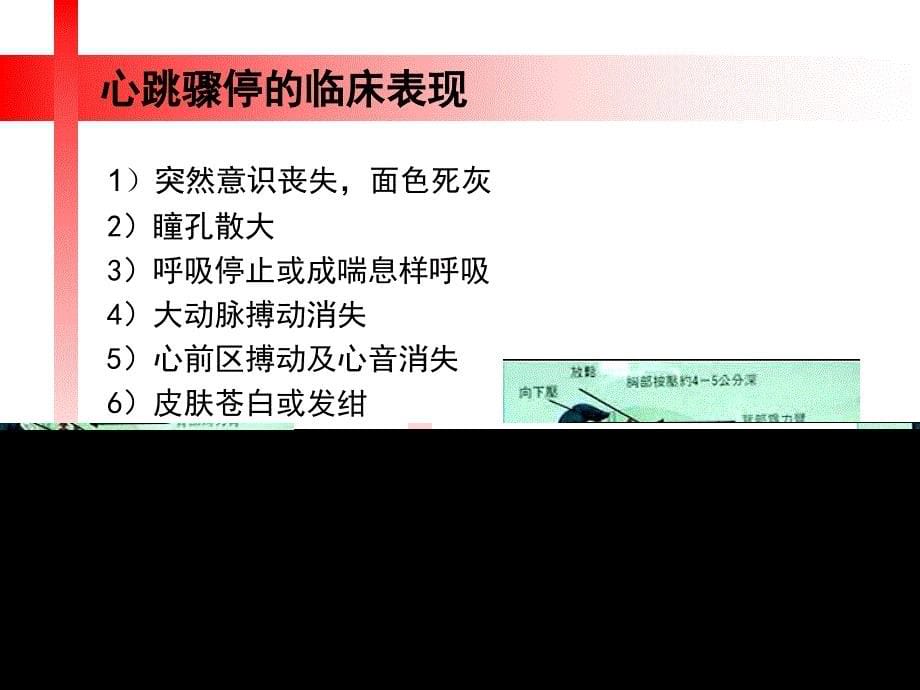 2019年心肺复苏cpr指南_第5页