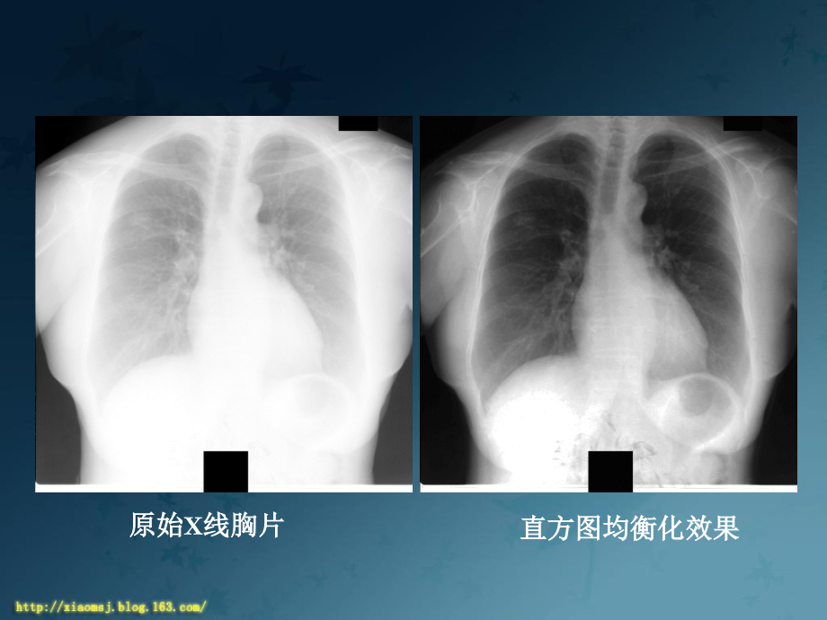 数字图像处理  图像复原与重建_第3页